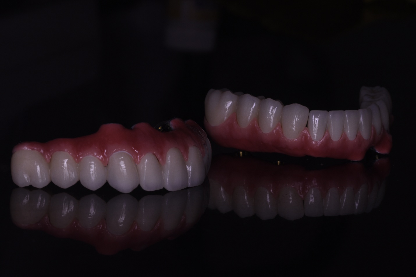 Full Arch Hybrid Prosthesis