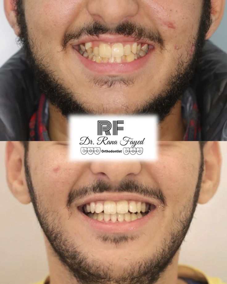 Orthodontics Before & After