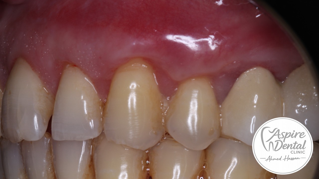 After