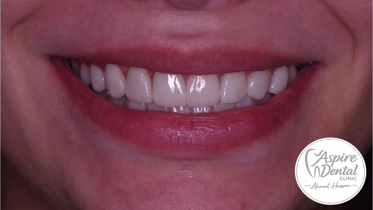 After